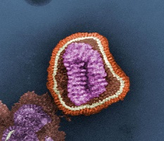Partícula viral o «virión» del virus de la gripe. (Fuente: Wikipedia)